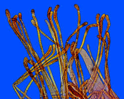 Attēlu rezultāti vaicājumam “Byssonectria fusispora”