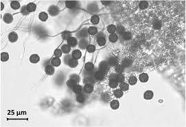 Attēlu rezultāti vaicājumam “Didymium clavus spores”