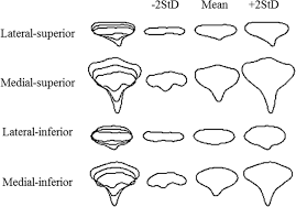 Image result for Triakis megalopterus