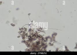Attēlu rezultāti vaicājumam “Didymium difforme spores”