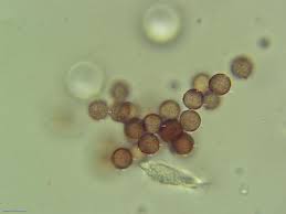 Attēlu rezultāti vaicājumam “Physarum globuliferum”