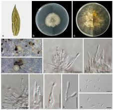 Attēlu rezultāti vaicājumam “Diachea muscorum spores”