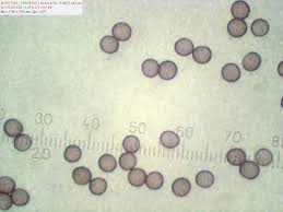 Attēlu rezultāti vaicājumam “Stemonitis pallida spores”