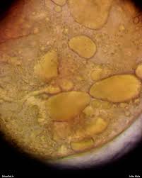 Attēlu rezultāti vaicājumam “Lycogala fuscoolearium macro”