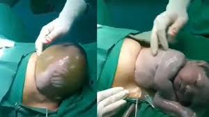 Image result for cesarskie