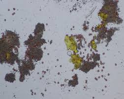 Attēlu rezultāti vaicājumam “Physarum contextum spores”