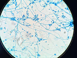 Attēlu rezultāti vaicājumam “Trichia longipalpis spores”