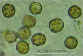 Attēlu rezultāti vaicājumam “Xanthoriicola physciae”