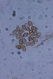 Attēlu rezultāti vaicājumam “Diderma rufostriatum sessile”