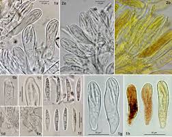 Attēlu rezultāti vaicājumam “Hyphodiscus hymeniophilus”