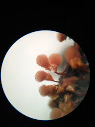 Attēlu rezultāti vaicājumam “Lycogala irregulare young”