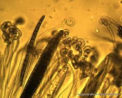 Attēlu rezultāti vaicājumam “Didymium difforme spores”