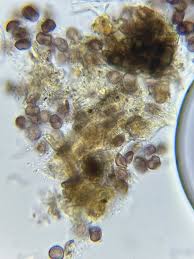 Attēlu rezultāti vaicājumam “Lamproderma elasticum spores”