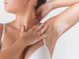 Image result for armpits are fine too