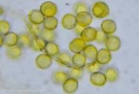 Attēlu rezultāti vaicājumam “Perichaena corticalis sessile”