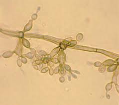 Attēlu rezultāti vaicājumam “Ophiostoma polyporicola”