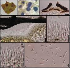 Attēlu rezultāti vaicājumam “Rhytisma acerinum”