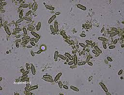 Attēlu rezultāti vaicājumam “Microcalicium disseminatum”