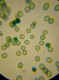 Attēlu rezultāti vaicājumam “Comatricha meandrispora macro”