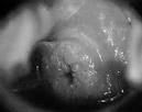 Volume 1, Chapter 30. Colposcopy