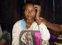 Kuvahaun tulos haulle Rochom