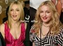 celebrity plastic surgery 2011