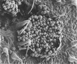 Attēlu rezultāti vaicājumam “Coleosporium sp.”