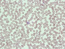 Attēlu rezultāti vaicājumam “Reticularia lobata plasmodium”