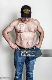 Image result for brust pumpe