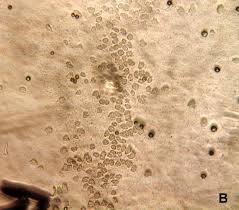 Attēlu rezultāti vaicājumam “Hemitrichia serpula spores”