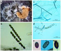 Attēlu rezultāti vaicājumam “Biscogniauxia granmoi”