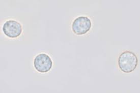 Attēlu rezultāti vaicājumam “Physarum auriscalpium spores”