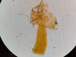 Attēlu rezultāti vaicājumam “Gulielmina vermicularis spores”