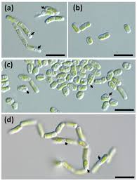 Attēlu rezultāti vaicājumam “Micarea sp.”