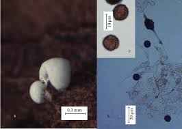Attēlu rezultāti vaicājumam “Didymium difforme spores”