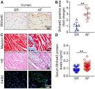 Frontiers | Cardiac-specific knockdown of Bhlhe40 attenuates ...