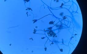 Attēlu rezultāti vaicājumam “Badhamia affinis var. microspora macro”