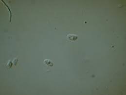 Attēlu rezultāti vaicājumam “Schizopora paradoxa”