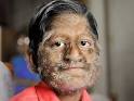 Werewolf Boy Appeals To