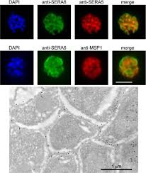 Attēlu rezultāti vaicājumam “Enteridium variabile plasmodium”