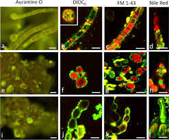 Attēlu rezultāti vaicājumam “Trentepohlia sp.”