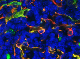 Image result for Thymus