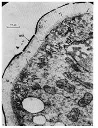 Attēlu rezultāti vaicājumam “Enteridium corticatum spores”