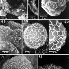 Attēlu rezultāti vaicājumam “Cribraria purpurea spores”