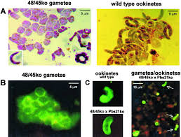 Attēlu rezultāti vaicājumam “Oligonema favogineum plasmodium”