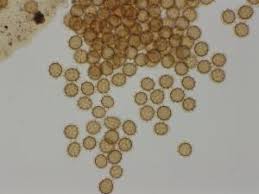 Attēlu rezultāti vaicājumam “Perichaena corticalis spores”