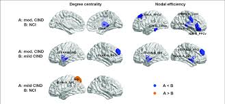 Image result for Cambridge N C I Cc