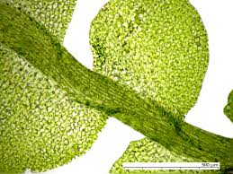 Attēlu rezultāti vaicājumam “Jungermannia hyalina cells”