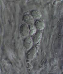 Attēlu rezultāti vaicājumam “Lecanora albella”