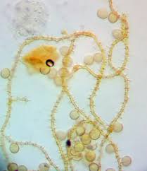 Attēlu rezultāti vaicājumam “Ophiotheca sp.”